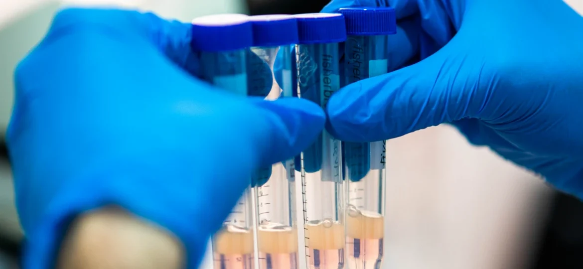 Conoce la calidad del semen y cómo varía