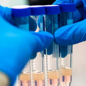 Conoce la calidad del semen y cómo varía